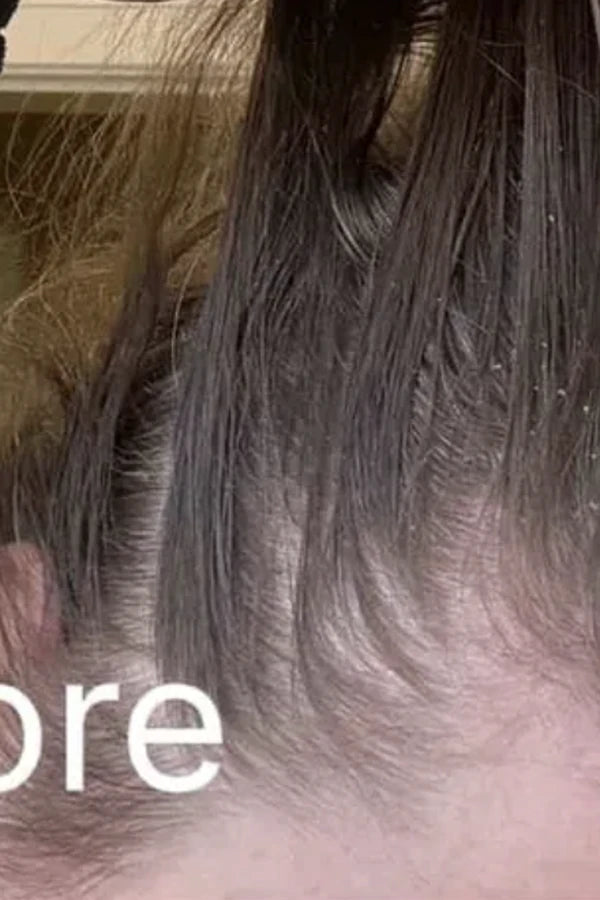 Before photo